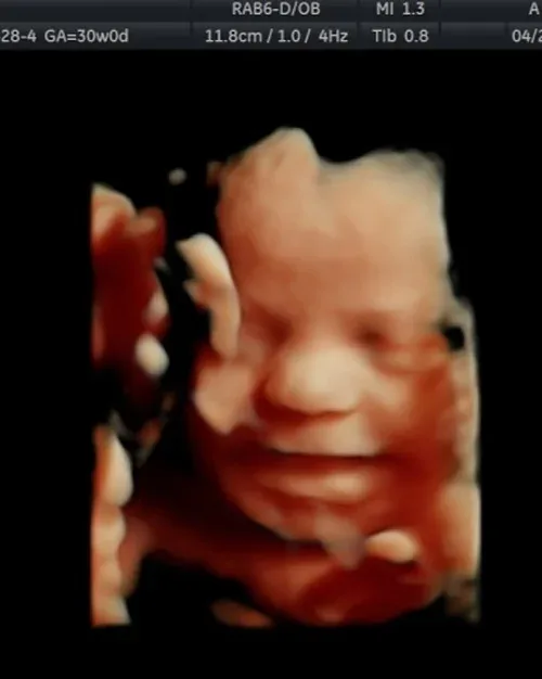 3D ultrasound baby with hand on cheek
